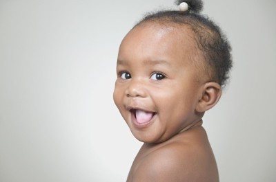 泛发型白癜风会对孩子造成什么危害